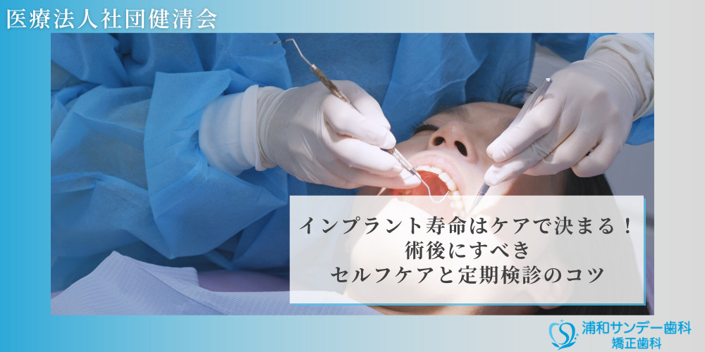インプラント寿命はケアで決まる!術後にすべきセルフケアと定期検診のコツ