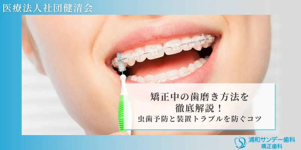 矯正中の歯磨き方法を徹底解説！虫歯予防と装置トラブルを防ぐコツ