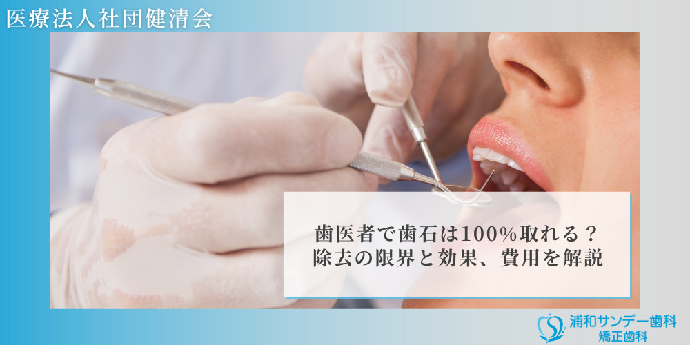 歯医者で歯石は100%取れる?除去の限界と効果、費用を解説