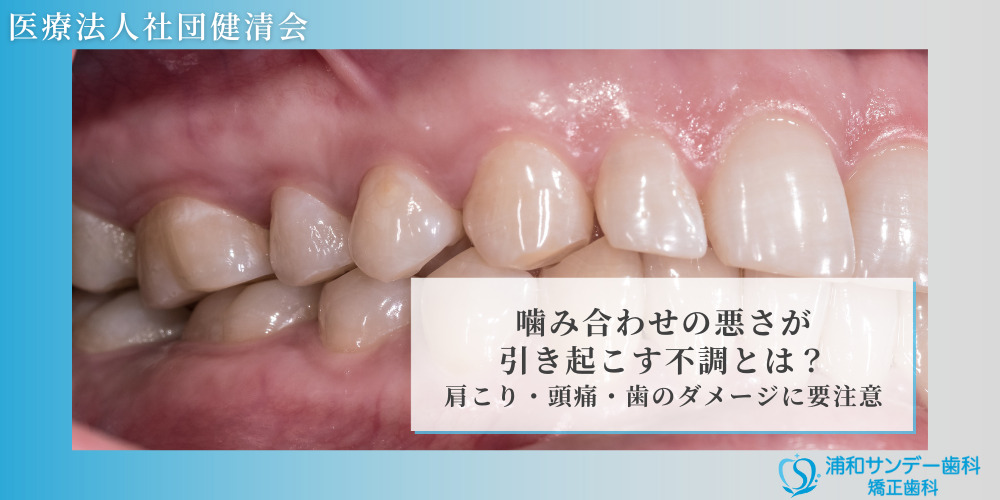 噛み合わせの悪さが引き起こす不調とは？肩こり・頭痛・歯のダメージに要注意