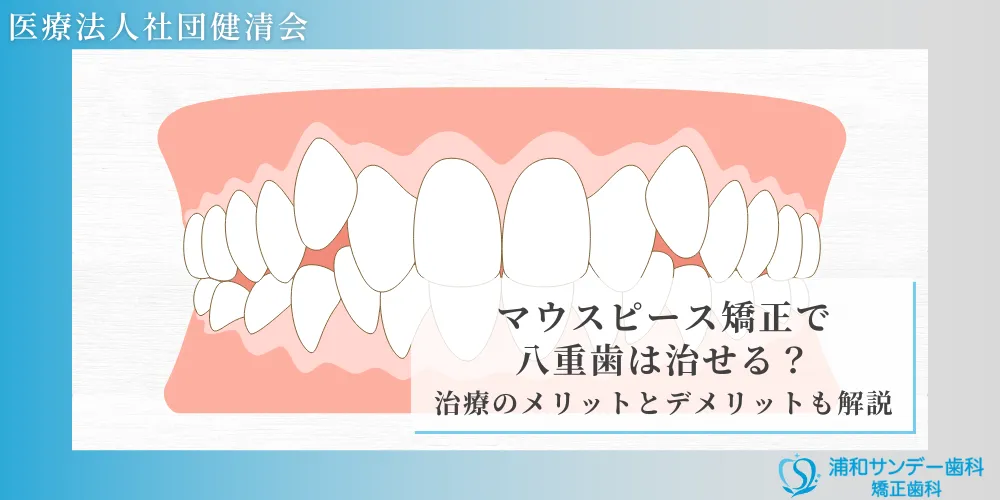 マウスピース矯正で八重歯は治せる？治療のメリットとデメリットも解説