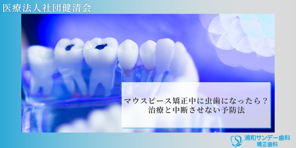 マウスピース矯正中に虫歯になったら?治療と中断させない予防法
