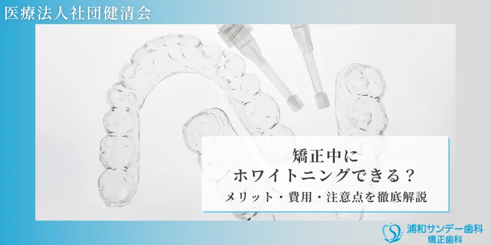 矯正中にホワイトニングできる？メリット・費用・注意点を徹底解説