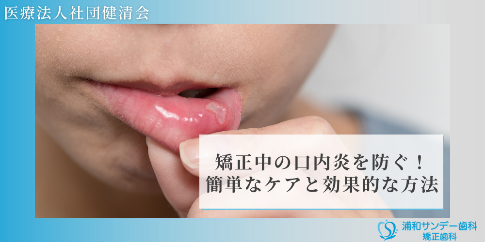 矯正中の口内炎を防ぐ！簡単なケアと効果的な方法