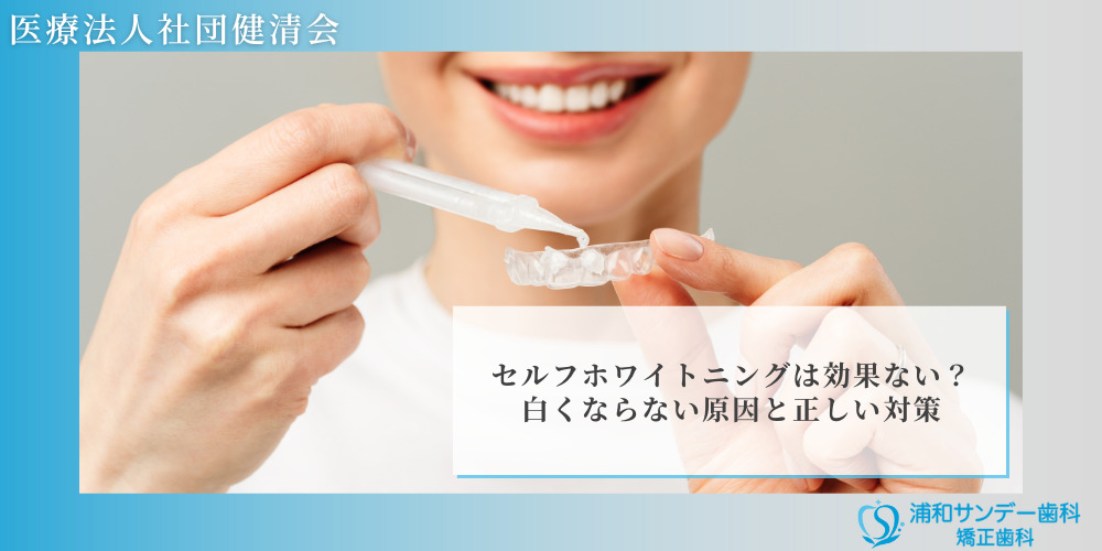 セルフホワイトニングは効果ない？白くならない原因と正しい対策