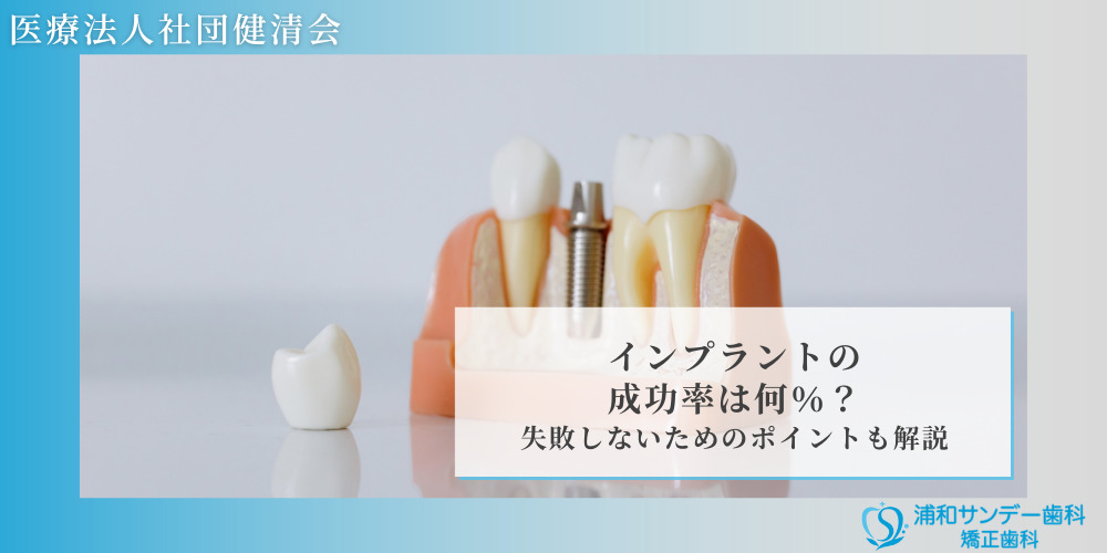 インプラントの成功率は何％？失敗しないためのポイントも解説