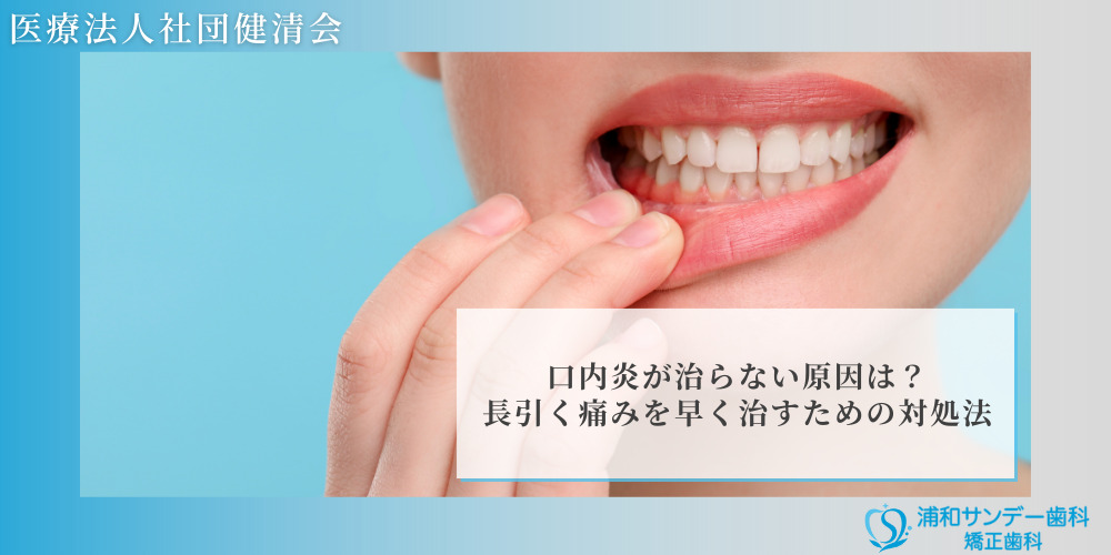 口内炎が治らない原因は?長引く痛みを早く治すための対処法