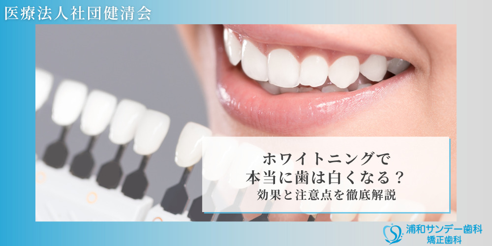ホワイトニングで本当に歯は白くなる？効果と注意点を徹底解説