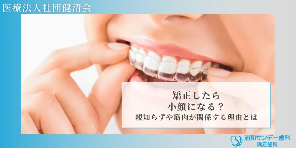 矯正したら小顔になる？親知らずや筋肉が関係する理由とは
