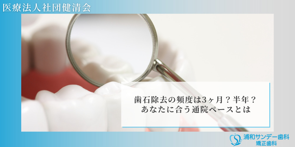歯石除去の頻度は3ヶ月?半年?あなたに合う通院ペースとは